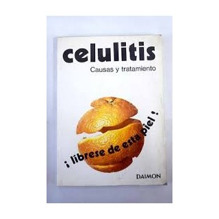 Celulitis. Causas y tratamiento.